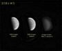 VENUS EN U CALCIUM K