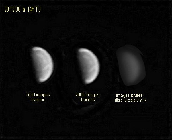 VENUS EN U CALCIUM K