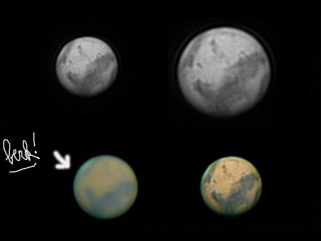 MARS ter autre traitement