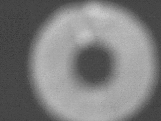 collim2