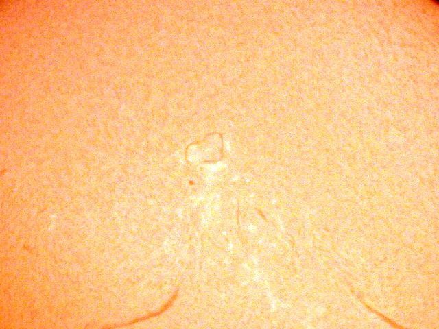 Coeur ardent sur plasma solaire